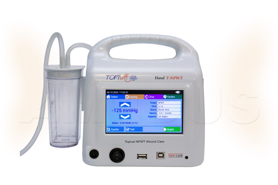 Classic Vacuum Assisted Wound Therapy NPWT Device: TopiVac Digital Hand